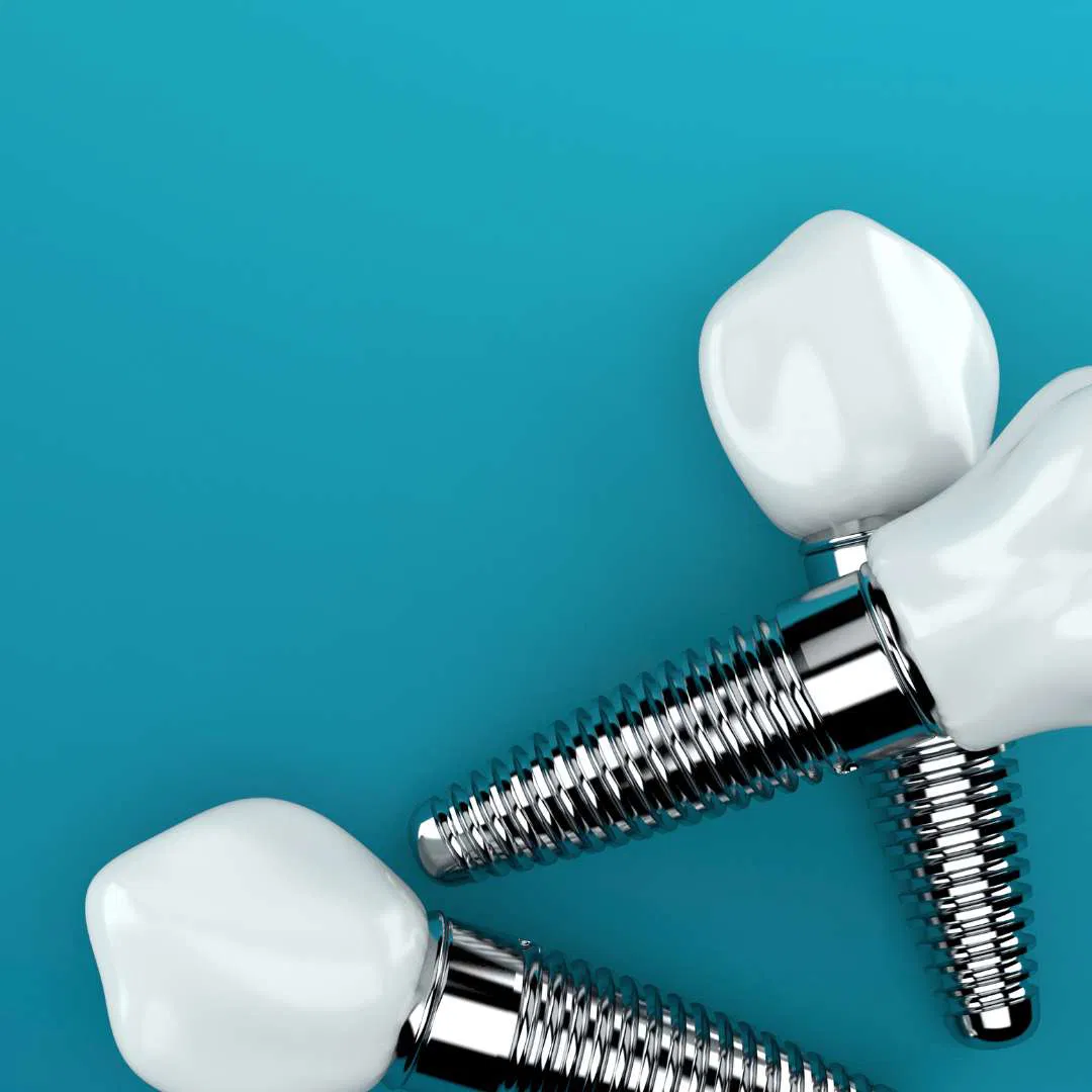 Tandreglering / Invisalign